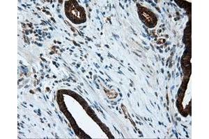 Immunohistochemical staining of paraffin-embedded liver tissue using anti-MTRF1L mouse monoclonal antibody. (MTRF1L 抗体)