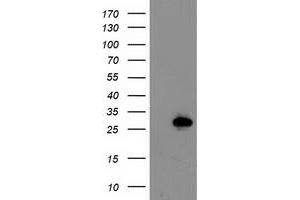 Western Blotting (WB) image for anti-Latexin (LXN) antibody (ABIN1499100) (Latexin 抗体)
