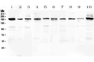Western blot analysis of PCDH15 using anti-PCDH15 antibody (ABIN6719362).