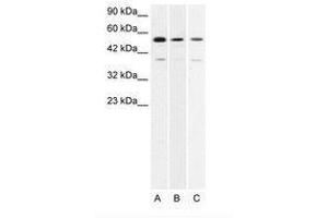Image no. 1 for anti-H2.0-Like Homeobox (HLX) (AA 257-306) antibody (ABIN202646) (HLX 抗体  (AA 257-306))