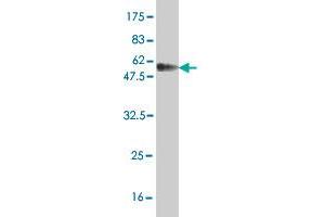 Western Blotting (WB) image for anti-DNA Repair Protein Homolog 1 (RAD51) (AA 1-242) antibody (ABIN562567)