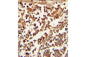 Formalin-fixed and paraffin-embedded human lymph tissue with SELL Antibody (C-term), which was peroxidase-conjugated to the secondary antibody, followed by DAB staining. (L-Selectin 抗体  (C-Term))