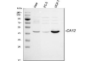 Western blot analysis of CA12 using anti-CA12 antibody (ABIN7601765).