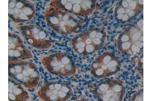 Detection of MMP12 in Human Rectum Tissue using Polyclonal Antibody to Matrix Metalloproteinase 12 (MMP12) (MMP12 抗体  (AA 290-469))
