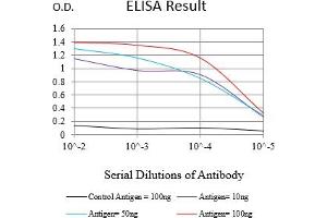 Black line: Control Antigen (100 ng),Purple line: Antigen (10 ng), Blue line: Antigen (50 ng), Red line:Antigen (100 ng) (Cytokeratin 13 抗体  (AA 104-458))