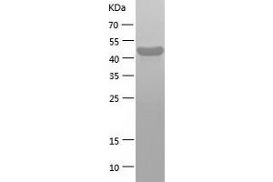 DDX39B Protein (AA 1-428) (His tag)