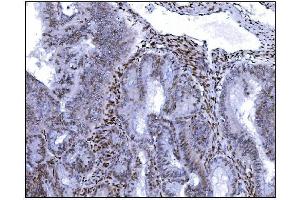 IHC analysis of Serum Response Factor/SRF using anti-Serum Response Factor/SRF antibody (ABIN7600213).