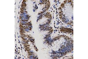 Immunohistochemistry (IHC) image for anti-Proline-, Glutamic Acid- and Leucine-Rich Protein 1 (PELP1) (AA 1021-1180) antibody (ABIN3023502)