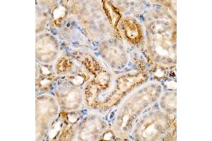 Immunohistochemistry of paraffin-embedded rat kidney using [KO Validated] Granulin Rabbit mAb  at dilution of 1:500 (40x lens). (Granulin 抗体)