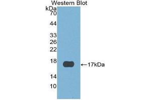 Western Blotting (WB) image for anti-Cystatin E/M (CST6) (AA 29-149) antibody (ABIN1867420) (CST6 抗体  (AA 29-149))