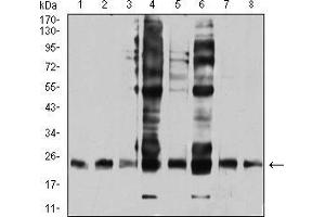 Western Blotting (WB) image for anti-V-Ral Simian Leukemia Viral Oncogene Homolog B (Ras Related, GTP Binding Protein) (Ralb) (AA 89-206) antibody (ABIN5542685)