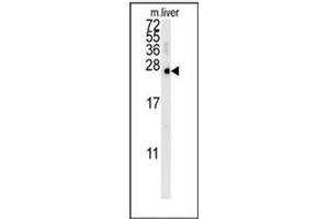 Western blot analysis of MCEE Antibody (C-term) in mouse liver tissue lysates (15ug/lane). (MCEE 抗体  (C-Term))