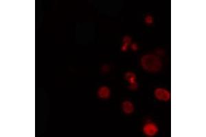ABIN6274330 staining Hela cells by IF/ICC. (FOXL1 抗体  (Internal Region))