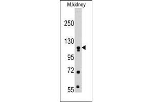 Image no. 1 for anti-Muscle, Skeletal, Receptor Tyrosine Kinase (MUSK) antibody (ABIN359904) (MUSK 抗体)