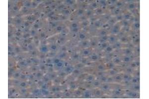 IHC-P analysis of Mouse Liver Tissue, with DAB staining. (Vip 抗体  (AA 28-159))