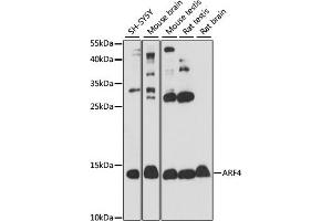 Western blot analysis of extracts of various cell lines, using  antibody (ABIN7265482) at 1:1000 dilution.