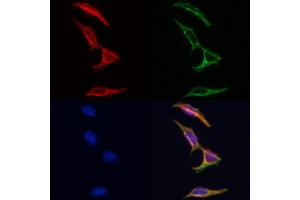 ABIN6262232 and ABIN6266695 staining Hela by IF/ICC. (HGS 抗体  (Internal Region))
