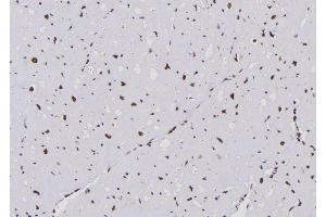 ABIN6276683 at 1/100 staining Human heart tissue by IHC-P. (APOBEC3G 抗体  (C-Term))
