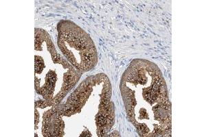 Immunohistochemical staining (Formalin-fixed paraffin-embedded sections) of human prostate with C3orf39 polyclonal antibody  shows strong cytoplasmic positivity in glandular cells. (C3orf39 抗体)