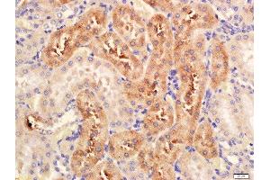 Formalin-fixed and paraffin embedded rat kidney labeled with Anti-Serine Racemase Polyclonal Antibody, Unconjugated  at 1:200 followed by conjugation to the secondary antibody and DAB staining. (SRR 抗体  (AA 1-100))