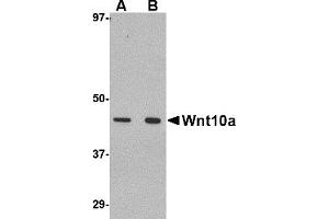 Western Blotting (WB) image for anti-Wingless-Type MMTV Integration Site Family, Member 10A (WNT10A) (C-Term) antibody (ABIN1030803) (WNT10A 抗体  (C-Term))
