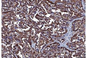 IHC analysis of CD147/Emmprin using anti-CD147/Emmprin antibody (ABIN7599998). (CD147 抗体  (AA 138-323))