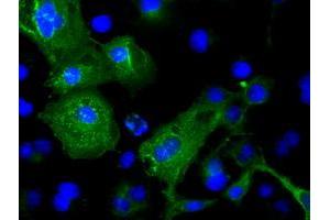 Image no. 2 for anti-Cardiac Troponin I (TNNI3) antibody (ABIN1497101) (TNNI3 抗体)