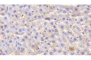 Immunohistochemistry (IHC) image for anti-Albumin (ALB) antibody (ABIN7429670)