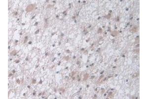 Immunohistochemistry (IHC) image for anti-serpin Peptidase Inhibitor, Clade A (Alpha-1 Antiproteinase, Antitrypsin), Member 5 (SERPINA5) (AA 43-406) antibody (ABIN7435505)