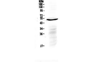 Western blot analysis of IL6R using anti-IL6R antibody . (IL-6 Receptor 抗体  (C-Term))
