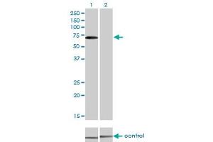 Western blot analysis of CARF over-expressed 293 cell line, cotransfected with CARF Validated Chimera RNAi (Lane 2) or non-transfected control (Lane 1).