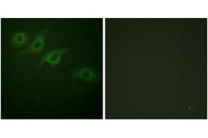Immunofluorescence analysis of HepG2 cells, using Interferon-gamma Receptor alpha chain (Ab-457) Antibody. (IFNGR1 抗体  (AA 431-480))