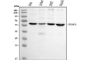 Western blot analysis of TOE1 using anti-TOE1 antibody (ABIN7601080).