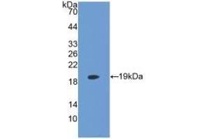 Detection of Recombinant LPCAT3, Human using Monoclonal Antibody to Lysophosphatidylcholine Acyltransferase 3 (LPCAT3) (LPCAT3 抗体  (AA 122-233))