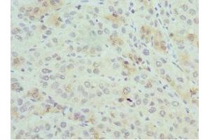 Immunohistochemistry (IHC) image for anti-Proteasome (Prosome, Macropain) Activator Subunit 1 (PA28 Alpha) (PSME1) (AA 1-249) antibody (ABIN7164913)
