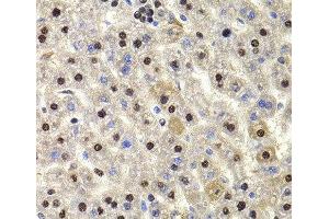 Immunohistochemistry of paraffin-embedded Rat liver using HIRIP3 Polyclonal Antibody at dilution of 1:100 (40x lens). (HIRIP3 抗体)