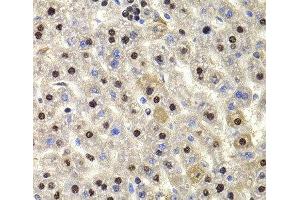 Immunohistochemistry of paraffin-embedded Rat liver using HIRIP3 Polyclonal Antibody at dilution of 1:100 (40x lens). (HIRIP3 抗体)
