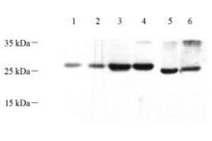 Western blot analysis of HOXD12 (ABIN7074252) at dilution of 1: 500 (HOXD12 抗体)