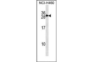 Western blot analysis in NCI-H460 cell line lysates (35 ug/lane) using S100B Antibody (Center) Cat. (S100B 抗体  (Middle Region))