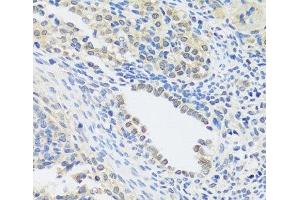Immunohistochemistry of paraffin-embedded Rat ovary using C12orf10 Polyclonal Antibody at dilution of 1:100 (40x lens). (C12orf10 抗体)