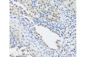 Immunohistochemistry of paraffin-embedded Rat ovary using C12orf10 Polyclonal Antibody at dilution of 1:100 (40x lens). (C12orf10 抗体)