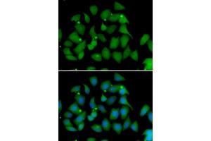 Immunofluorescence analysis of HeLa cell using FMO1 antibody. (FMO1 抗体)
