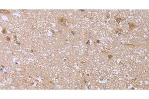 Immunohistochemistry of paraffin-embedded Human brain using FHL2 Polyclonal Antibody at dilution of 1:40 (FHL2 抗体)