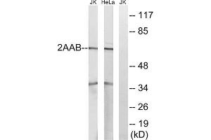 Western blot analysis of extracts from Jurkat cells and HeLa cells, using PPP2R1B antibody. (PPP2R1B 抗体  (C-Term))