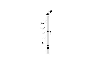 Anti-C12orf30 Antibody (Center) at 1:1000 dilution + HL-60 whole cell lysate Lysates/proteins at 20 μg per lane. (NAA25 抗体  (AA 720-748))