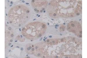 Detection of UNG in Human Kidney Tissue using Polyclonal Antibody to Uracil DNA Glycosylase (UNG)