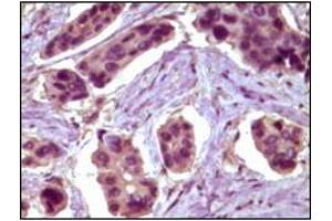 Immunohistochemistry (IHC) image for anti-B-Cell CLL/lymphoma 10 (BCL10) antibody (ABIN2464015) (BCL10 抗体)