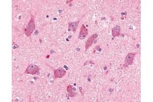 Immunohistochemical staining of human brain, neurons and glia (BAI2 抗体  (N-Term))
