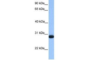 WB Suggested Anti-ZMAT3 Antibody Titration:  0. (ZMAT3 抗体  (N-Term))