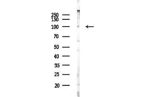 Western blot analysis of lysates from F10-LUC cells(heat-shock 45 min treatment), using OGFR Antibody at 1/1000 dilution.